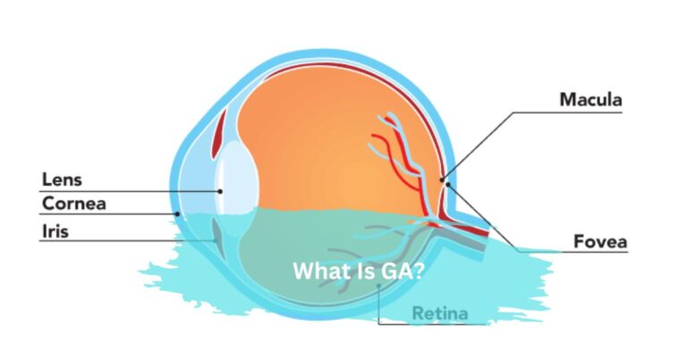 What Is GA? – Understanding A Progressive Eye Condition!